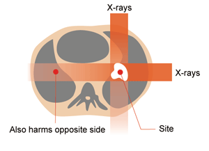 X-ray radiation