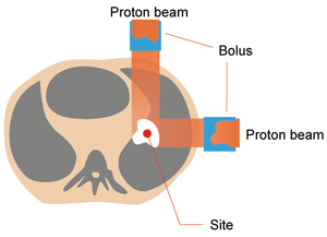 Proton beams