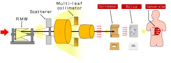 Double-scattering irradiation